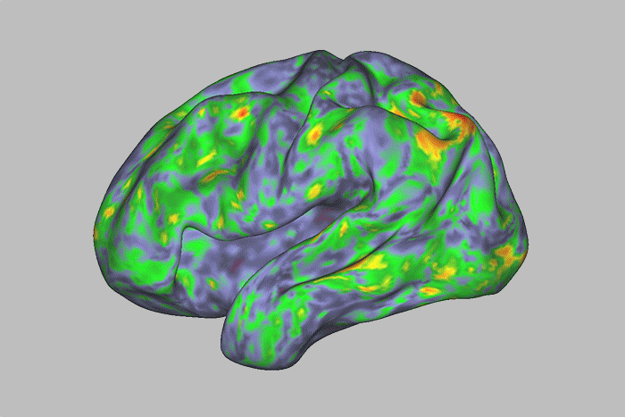 Our Brain on Psilocybin: Understanding the Science Behind the Experience